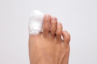 The Prevalence of Broken Toes
